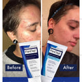 PanOxyl Acne Foaming Wash