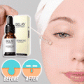 ZeroPore Instant Perfection Serum